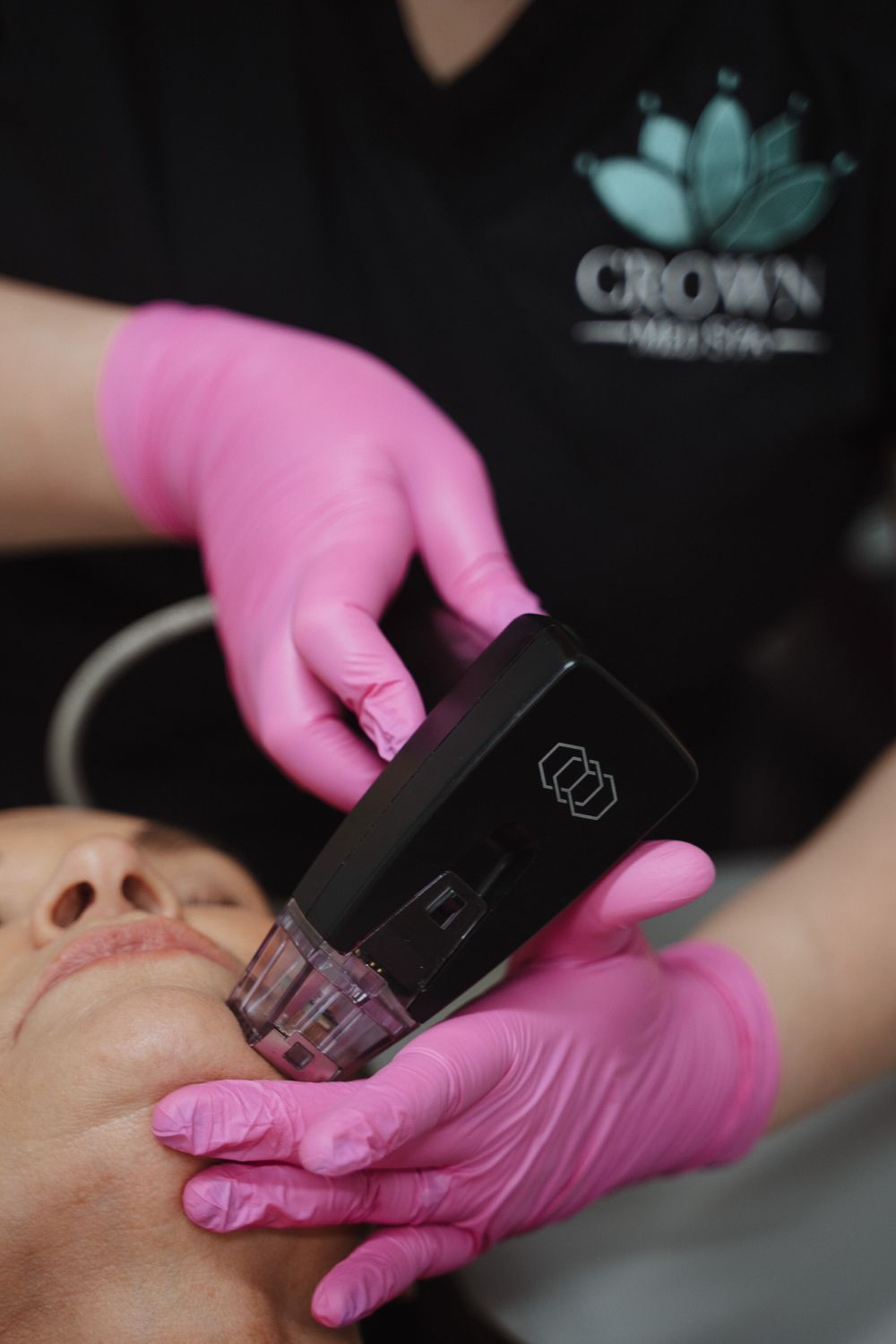 Crown Point Facial Treatment model with blonde hair with arm in front of her her forehead