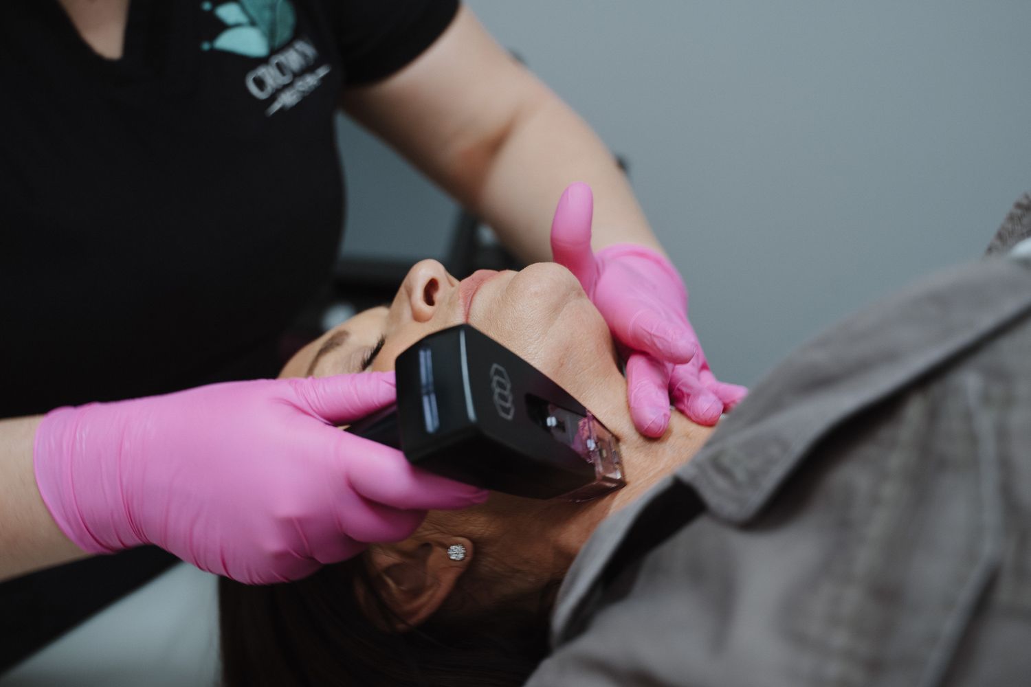 Crown Point Double Chin Treatment model with blonde hair