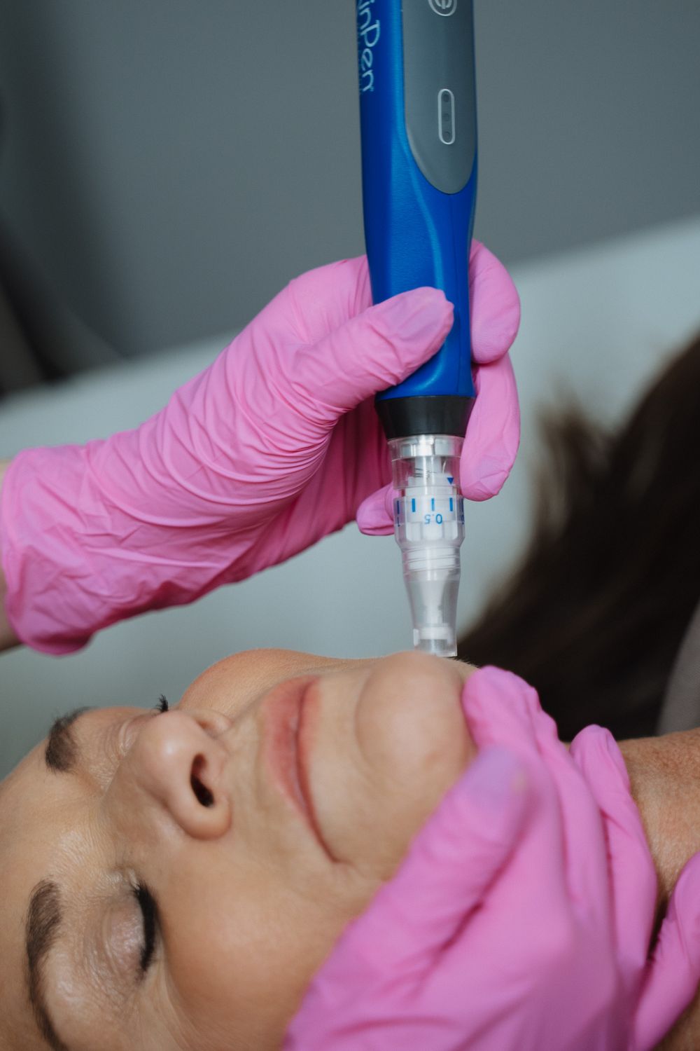 Crown Med Spa patient receiving skinpen treatment