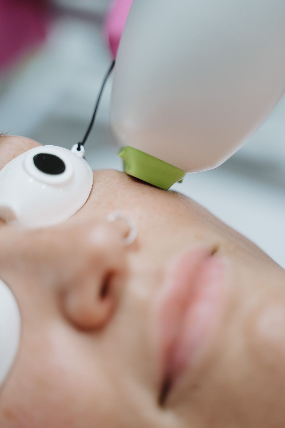 Crown Point Photofacial model with eyes closed touching her chin