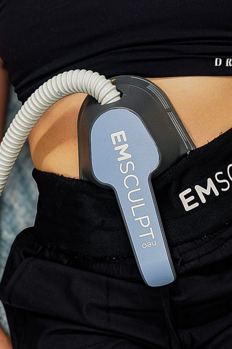 Emsculpt device attached to abdomen for body contouring.