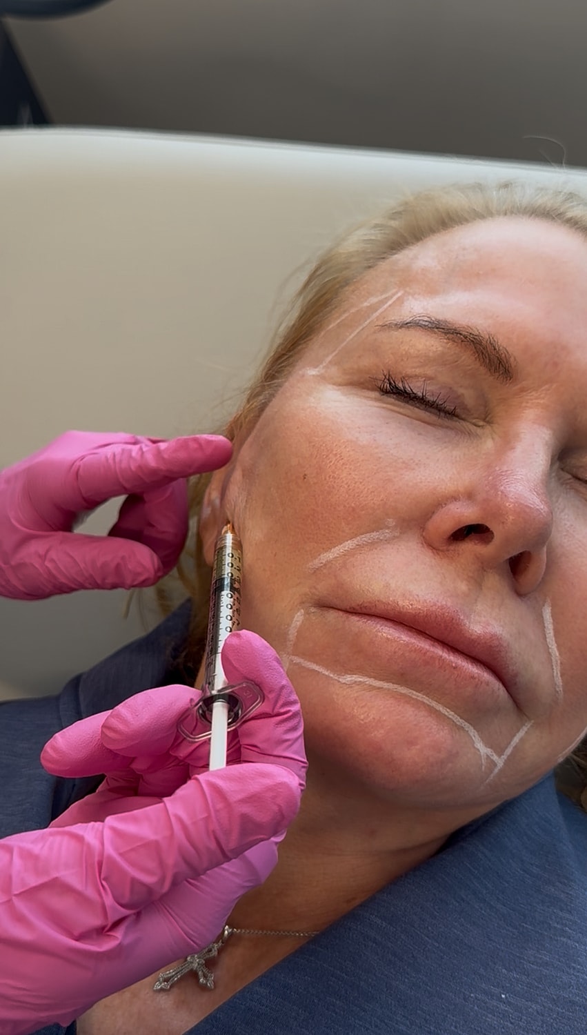 Crown Point Derma PRP model with brown hair touching her chin