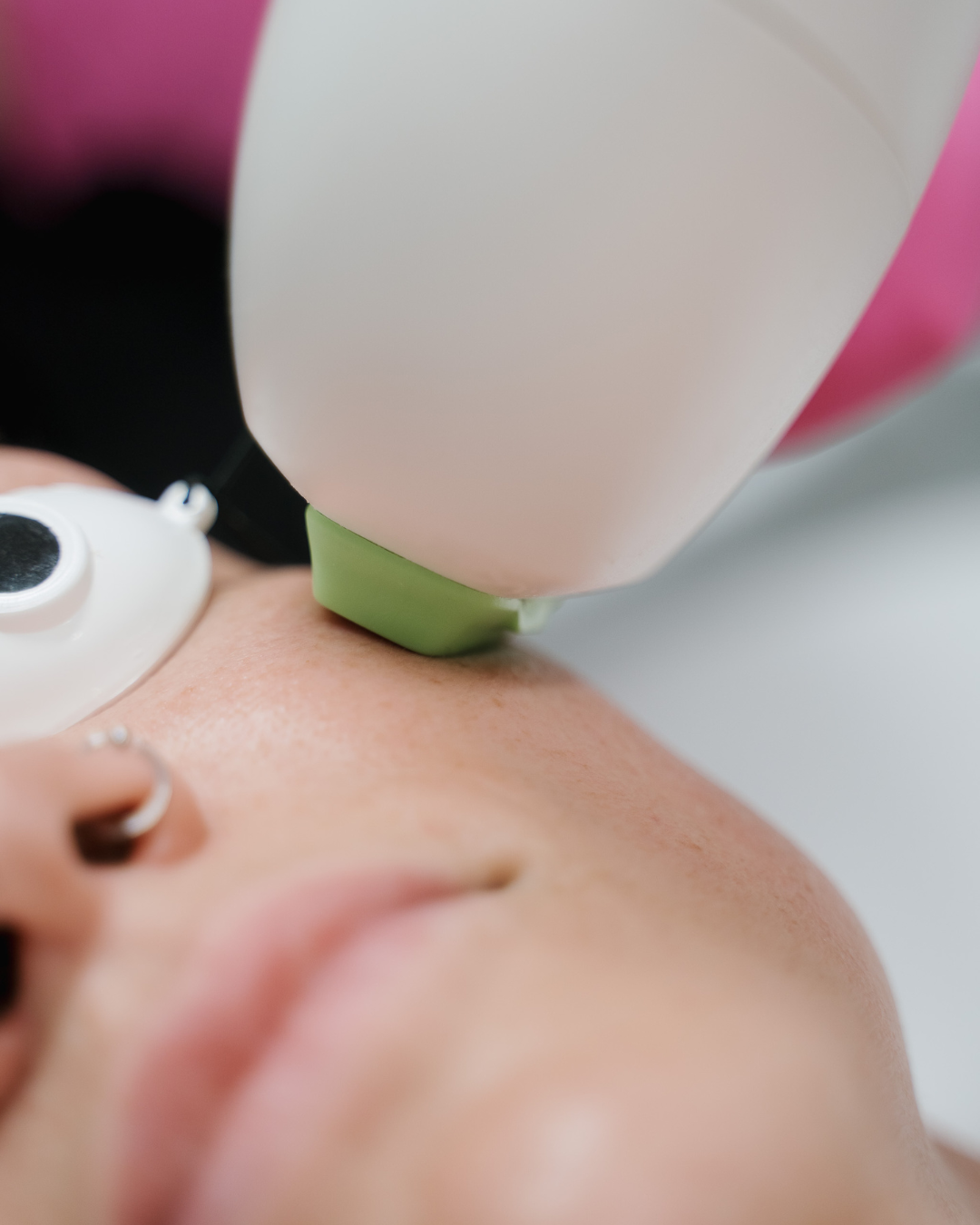 Crown Point Laser Treatment patient model receiving treatment