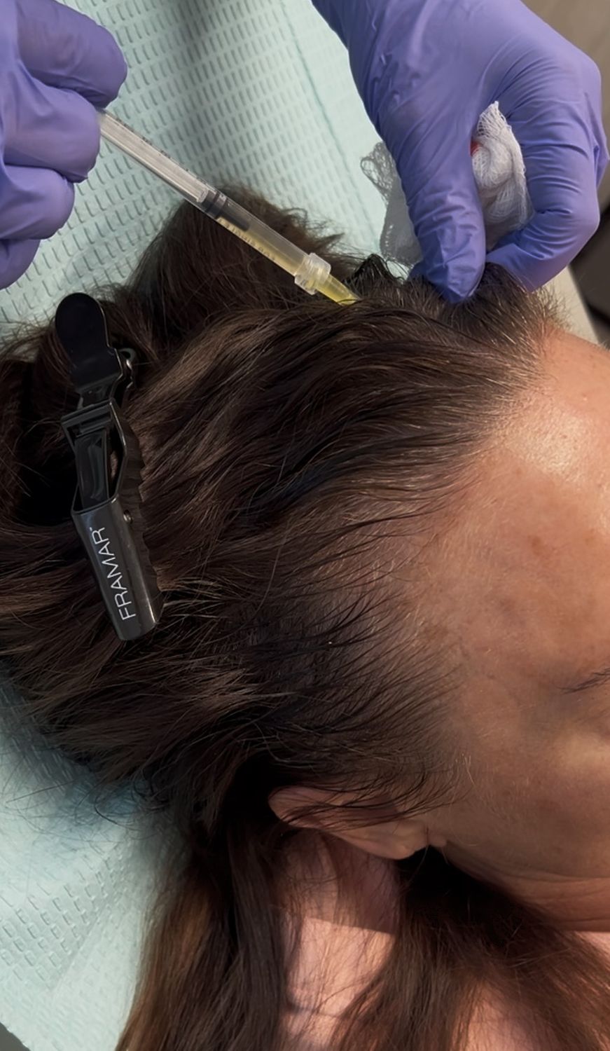 Crown Med Spa patient receiving PRP treatment