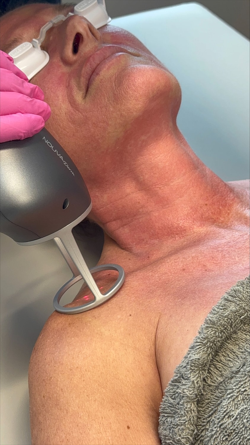 Crown Point NOUVADerm Model