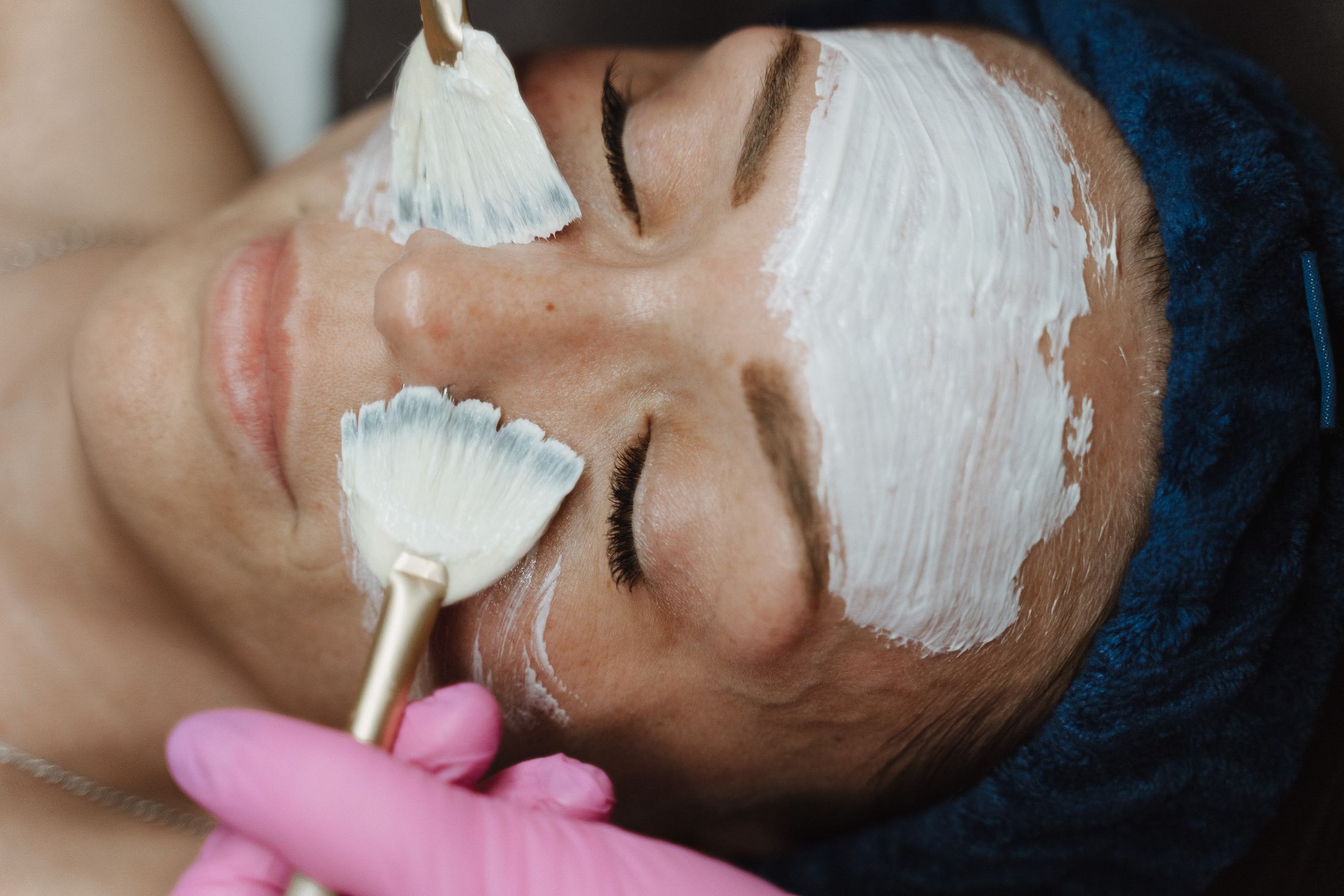 Crown Point Chemical Peel model with long hair wearing a white shirt