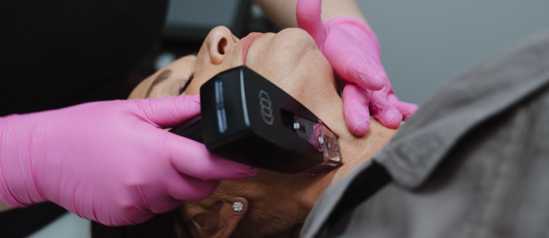 Crown Point Med Spa model with red hair